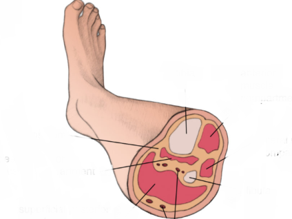 Chronic Exertional Compartments Syndrome