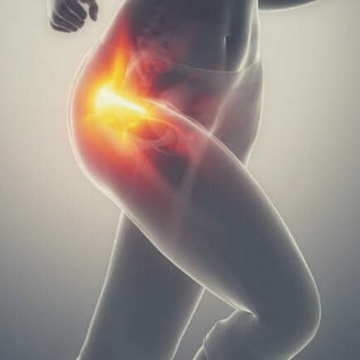 Osteoarthritis of the hip - تهاب المفاصل النمائي للورك
