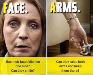 stroke signs1